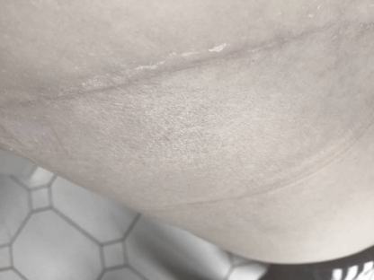 Scar after tummy tuck 1 month
