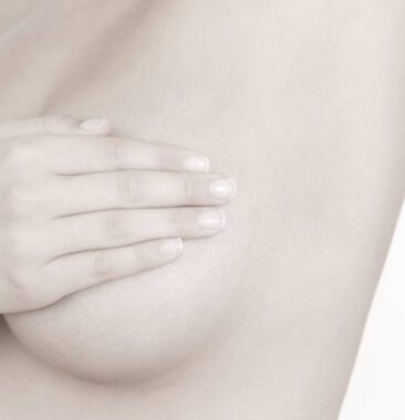 Breast Augmentation Dr. Scholz